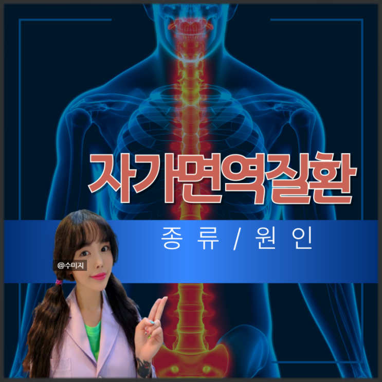  자가면역질환 종류 원인, 전신경화증 레이노증후군