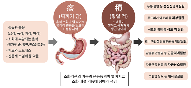  청주담적증치료. 배가 묵직하게 아프면서 잠도 안와요 (ft. 구역감 위경련) [율량동더바른한의원]