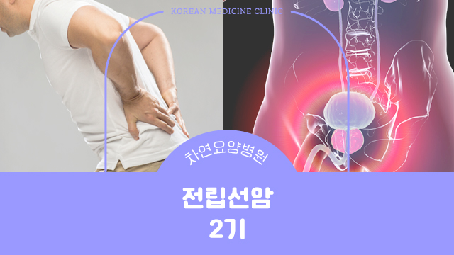  전립선암 2기 증상과 개선위한 생활관리법