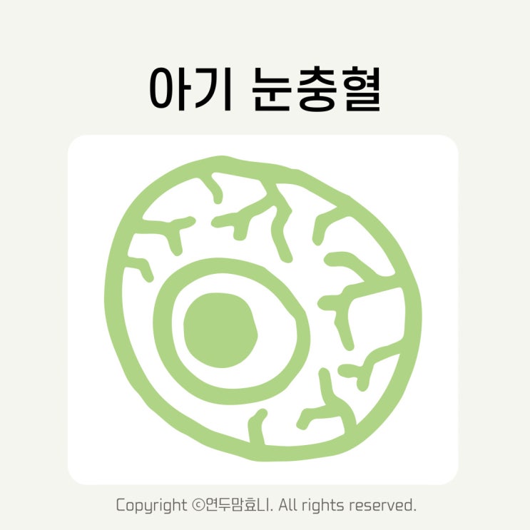 아기 눈충혈 눈비비기 유아 결막염 눈에빨간점 전염 증상 치료 아기 눈충혈 눈비비기 유아 결막염 눈에빨간점 전염 증상 치료