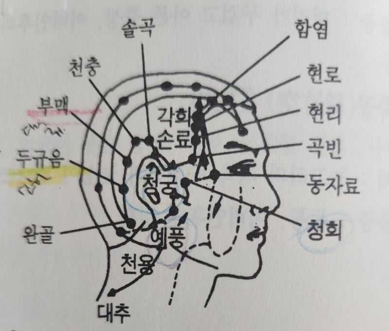 귀 이명에 좋은 17자리 혈자리 경혈점, 신허 이명치료