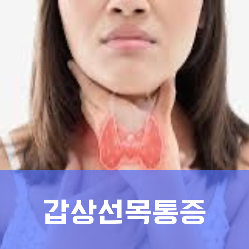 목 통증 갑상선 목부음 이물감