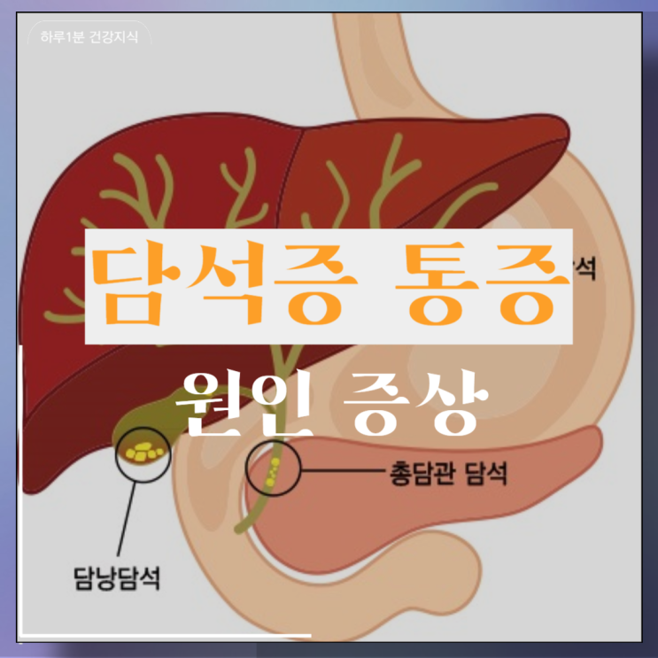  담석증 통증 원인 증상