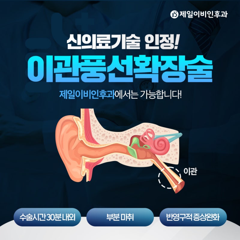 귀가 막힌느낌 심하면 #이관기능부전증 #이관풍선확장술 고려