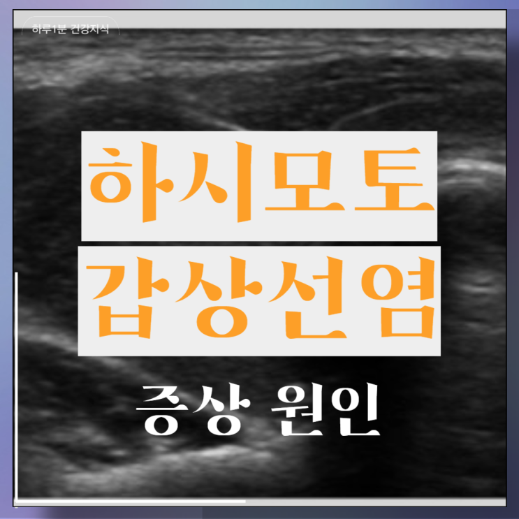  하시모토 갑상선염 증상 원인 치료