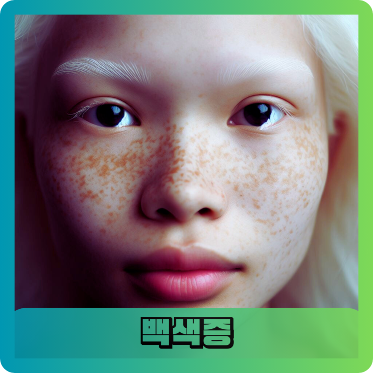  안구 피부 머리카락 백색증 증상과 원인을 알아보자