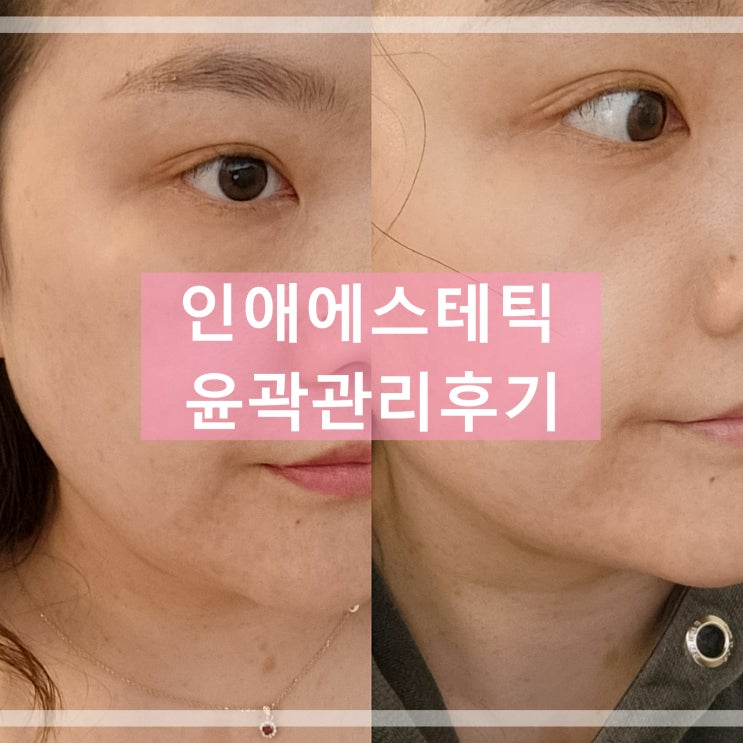  부천피부관리 잘하는 곳 인애에스테틱 윤곽관리후기