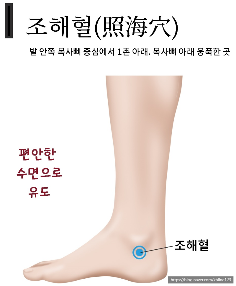 불면에 좋은 혈자리, 잠 안올때 눌러주면 좋은 혈자리 : 네이버 블로그