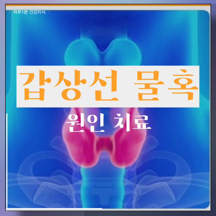  갑상선 물혹 혹 원인 치료 요오드 결핍
