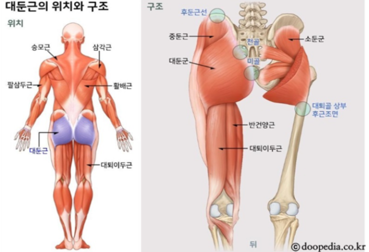  암환자가 미골교정을 해야하는 이유 2탄