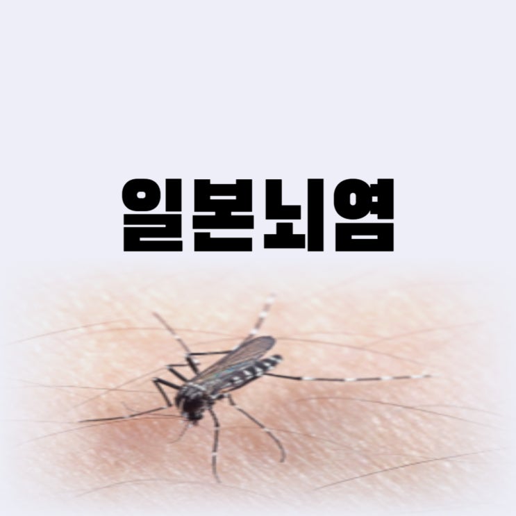  일본뇌염 4차 5차 예방접종 가격 시기 일본뇌염 생백신 사백신 차이