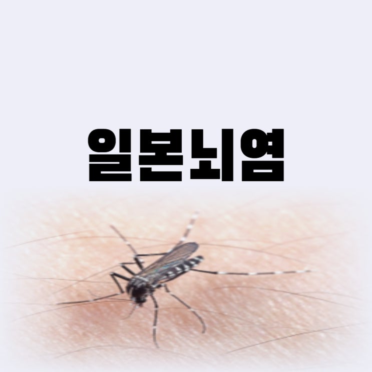 일본뇌염 4차 5차 예방접종 가격 시기 일본뇌염 생백신 사백신 차이