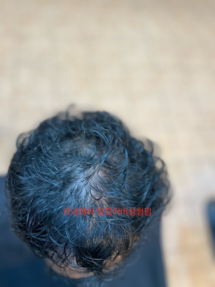  머리잘하는부산사상르네시떼미용실 두피케어와해독염색그리고 탈모펌동시공략/ 사상구남구중구동구영도구사하구북구해운대구김해시금정구기장군진구경남경북