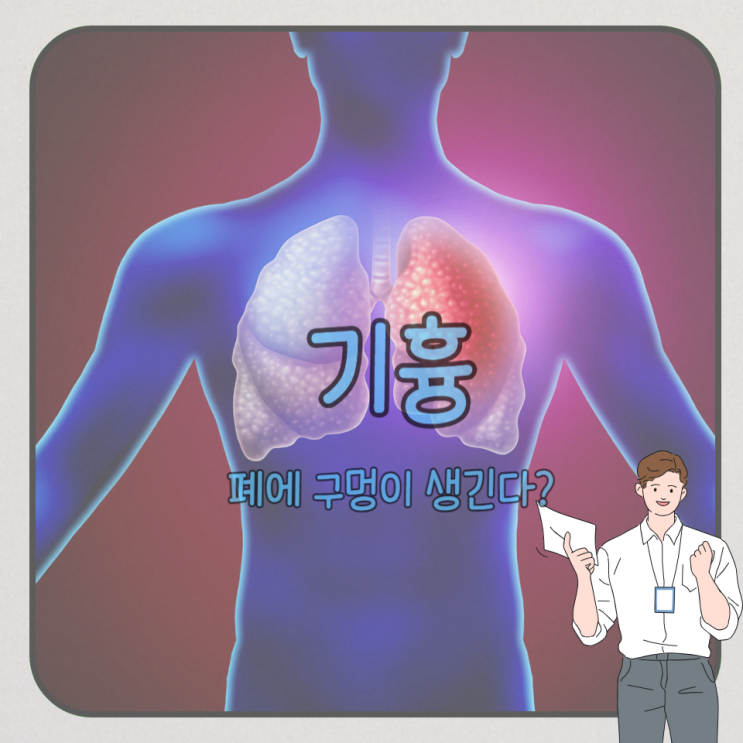 <b>기흉</b> 증상 종류, 수술 재발은?