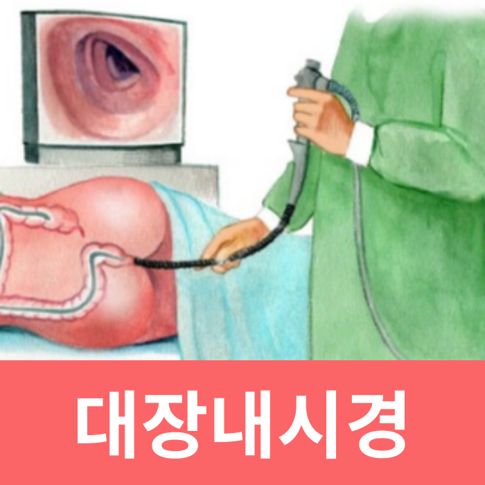 대장내시경 용종제거 식단 커피 주의사항