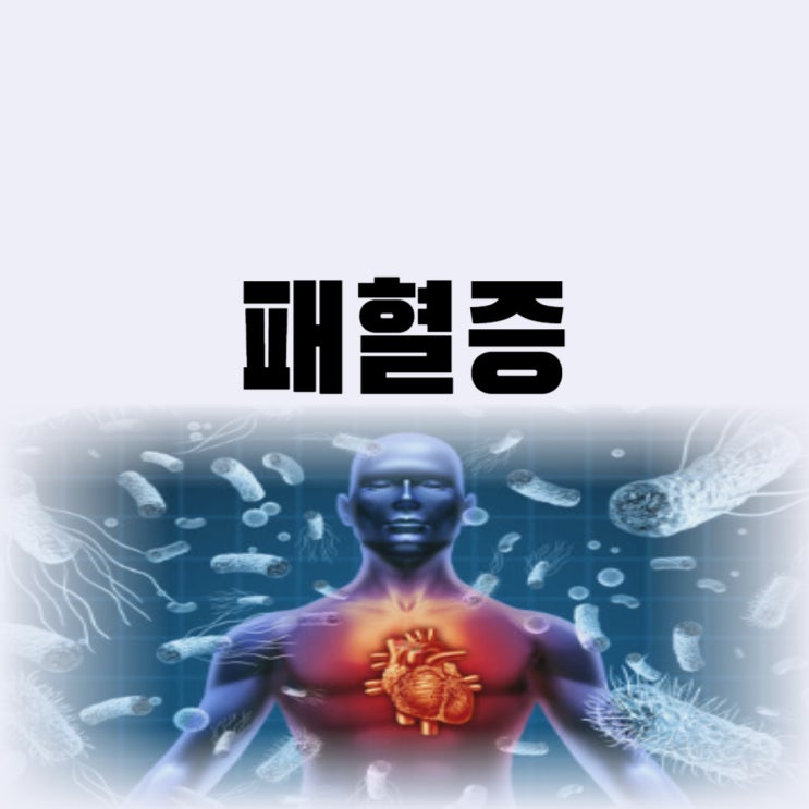  패혈증 뜻 초기증상 사망률이 높은 이유(폐혈증)