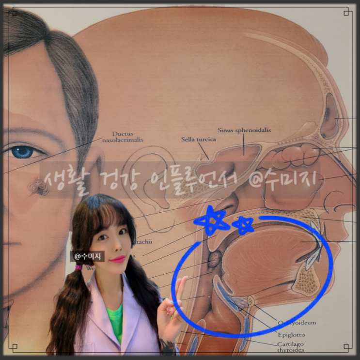  목이 타는 느낌 급성 인후염 증상 원인 만성 인후염 급성 후두염