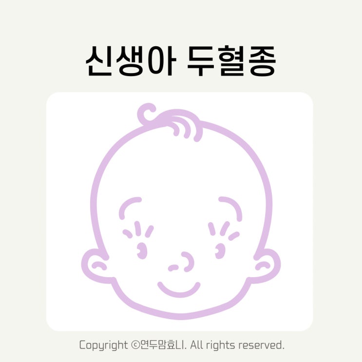 신생아 두혈종 아이 아기 머리혹 모유 황달 원인 치료 어떻게? 신생아 두혈종 아이 아기 머리혹 모유 황달 원인 치료 어떻게?