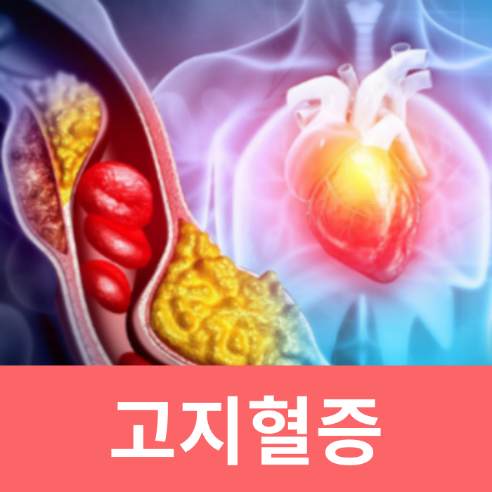  고지혈증 나쁜 음식 좋은 음식 약 부작용 증세 수치