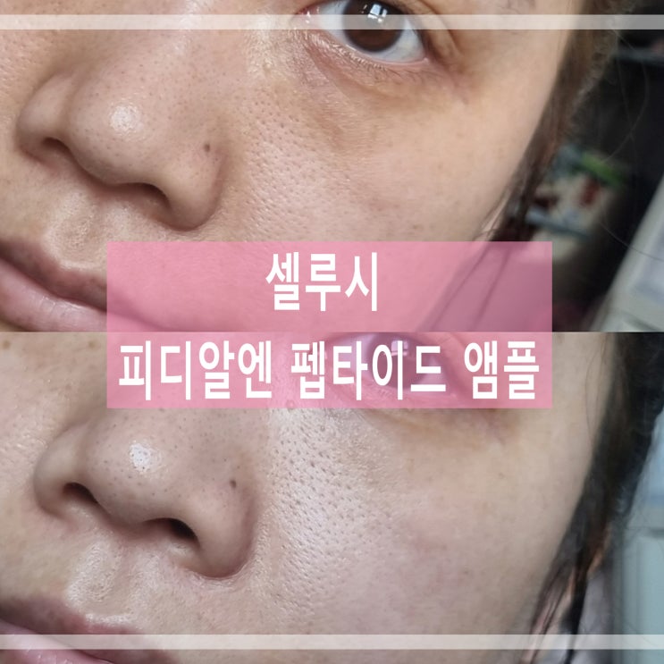  집에서 쉽게 피부관리 스킨부스터 앰플 러블리블랑 셀루시 피디알엔 펩타이드 앰플 PDRN 세럼 사용후기