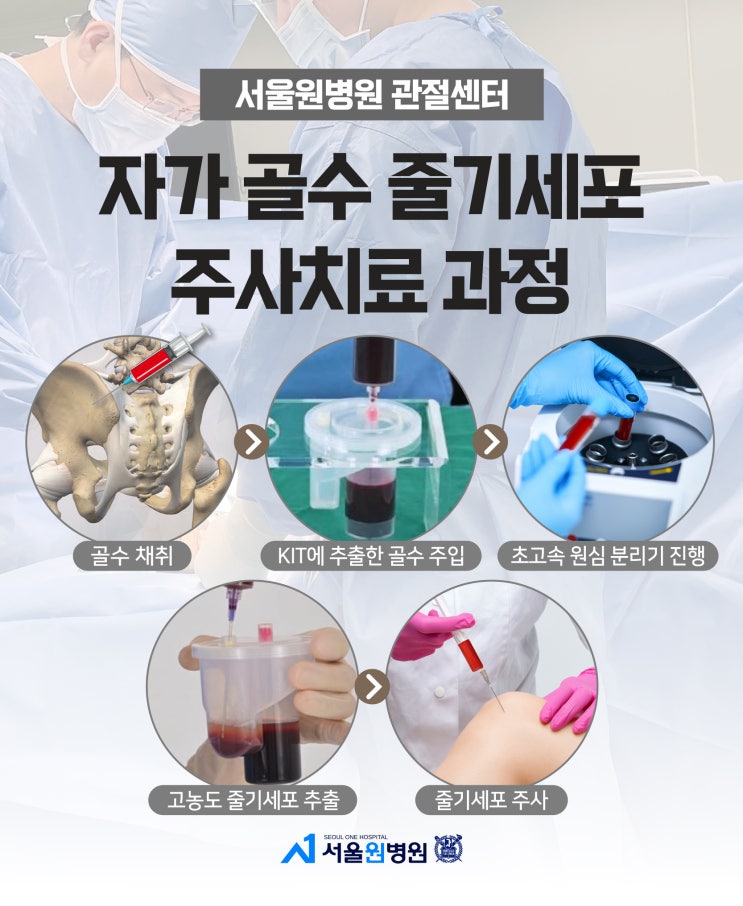  퇴행성 무릎관절염 자가골수줄기세포 주사치료(BMAC) 는 서울원병원