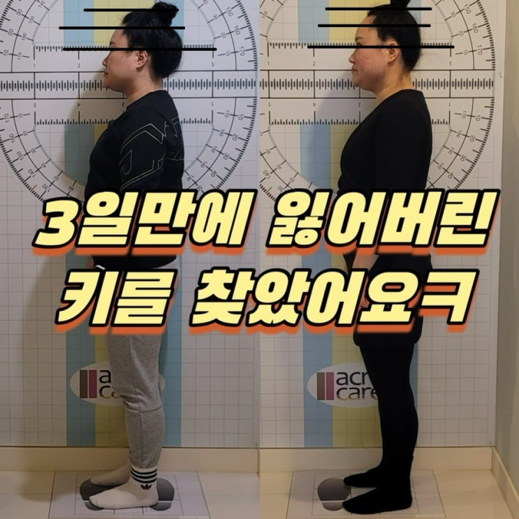  광교 통증관리 거북목 솟은등 한방에 해결! 마사지 보다 영앤밸런스 테라피 (내돈내산)
