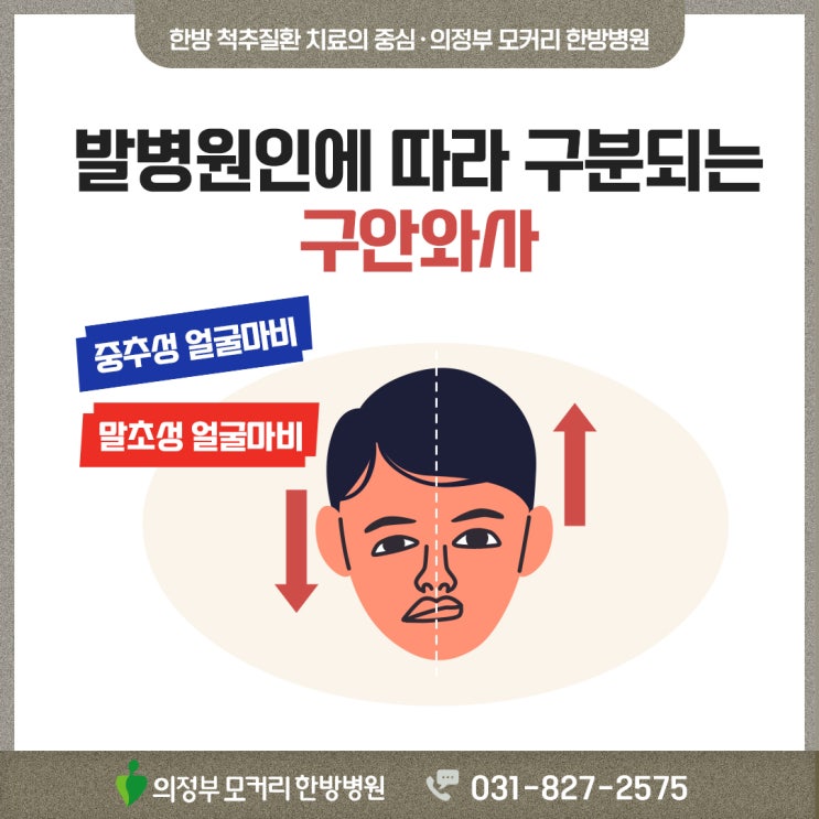  의정부안면마비 모커리한방병원 치료가 유명한 이유