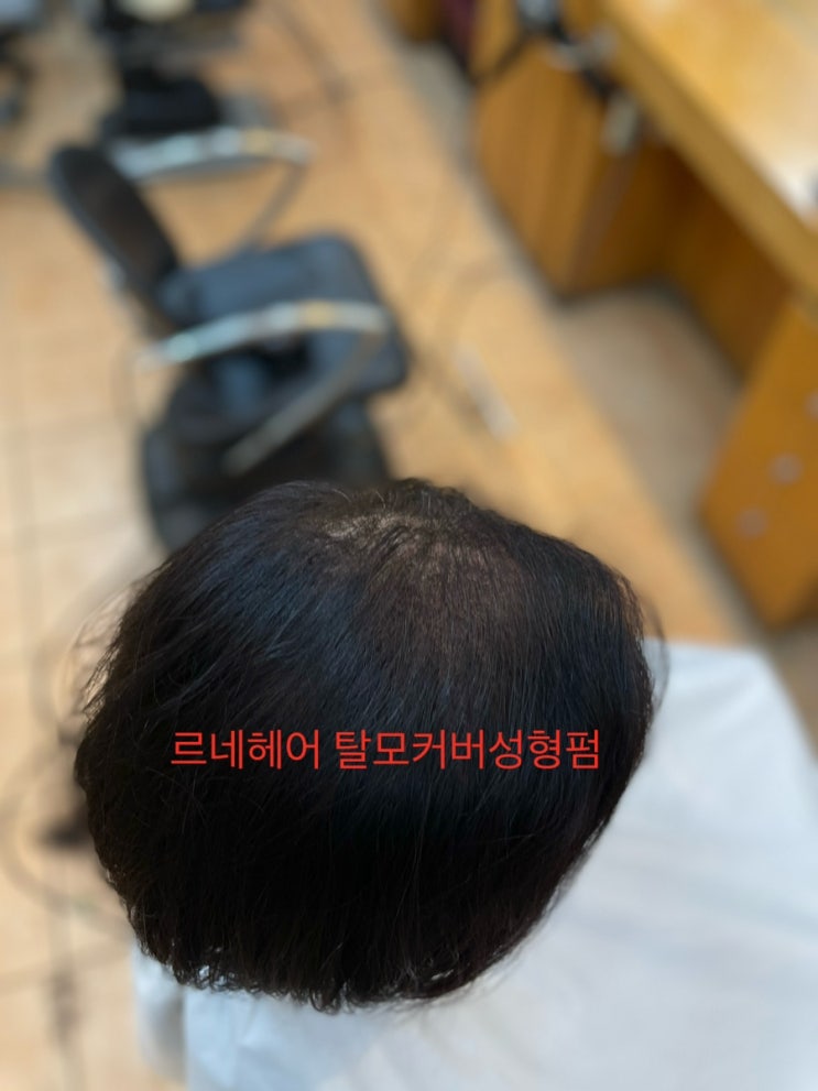  여자 탈모 극복 탈모 성형 펌 부산탈모전문미용실르네시떼사상헤어샵/ 감전주례구덕모하남포개금부암서면진구전포부전양정수영망미동래명륜사직장전해운대광안리수영망미초읍남천김해용원울산양산대저화명