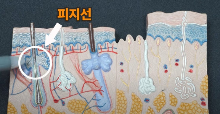  여드름빨리없애는법 청소년 얼굴 여드름 자가관리
