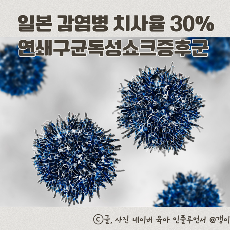  일본감염병 치사율 30% 연쇄구균독성쇼크증후군 확산 전염