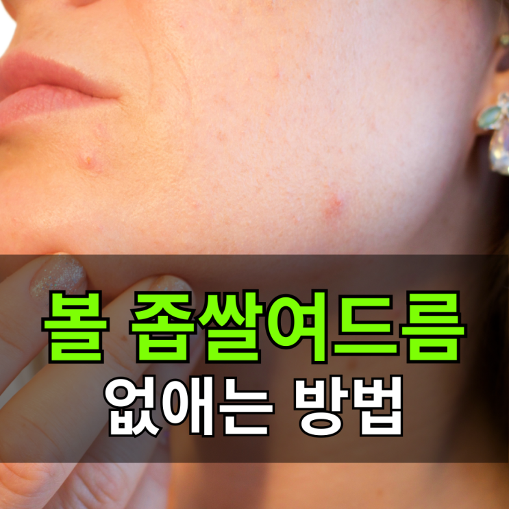  볼 좁쌀여드름 없애기 원인 해결 방법