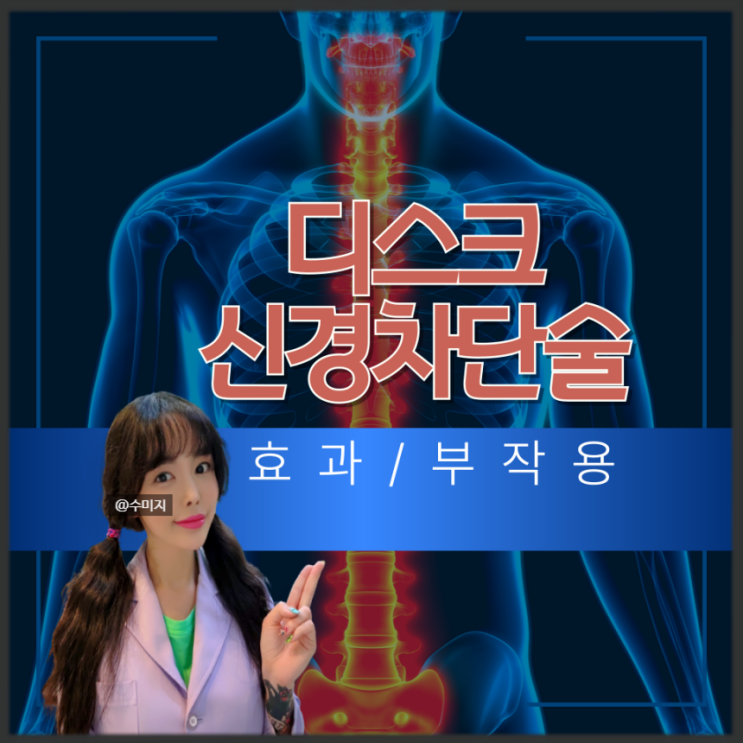  허리디스크 증상 치료 신경차단술 부작용 효과 요추 통증 (경막외신경차단술)