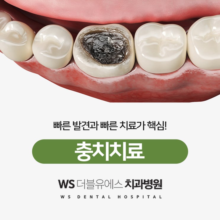  해운대좌동치과 빠른 치료가 핵심