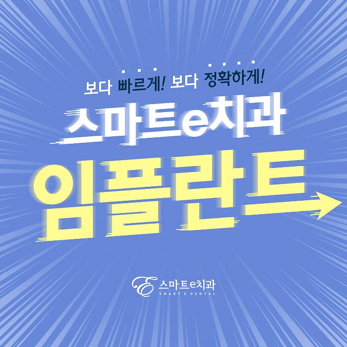 서면 임플란트 차이점 및 기준