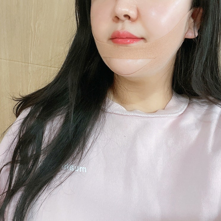  턱선지킴이 매일쓰는 홈케어 리프팅밴드 아이디에이지 후기