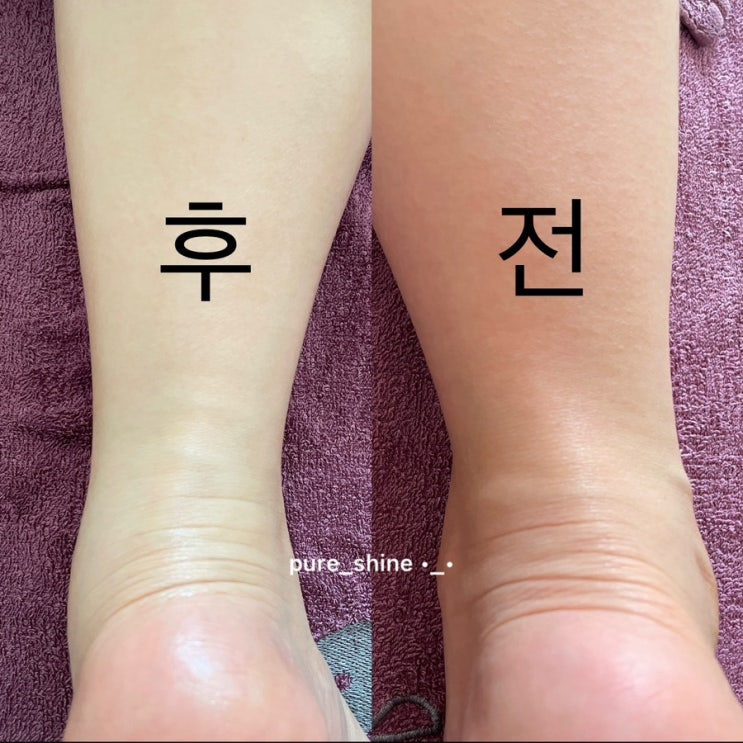  인천산후마사지 첫만남이용권 사용가능 위더스산후케어