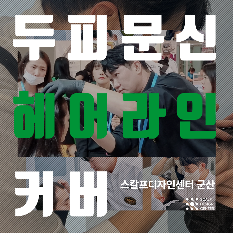  전주 익산 군산 두피문신으로 헤어라인 교정하는 법