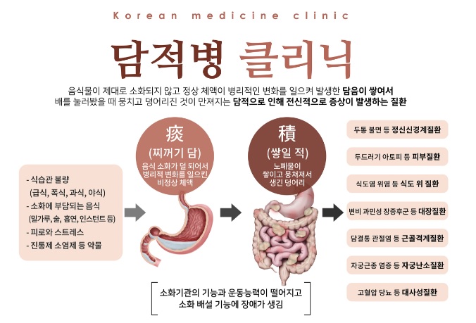  청주 담적. 담적증이 있다면 꼭 치료받으세요 (ft. 원인치료) [율량동더바른한의원]