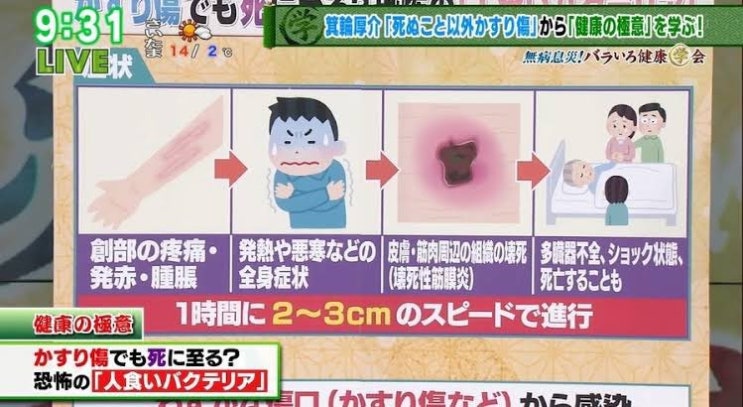 북한, 일본 독성 점염병 유행! 평양서 <b>월드컵 예선 개최</b> 불가