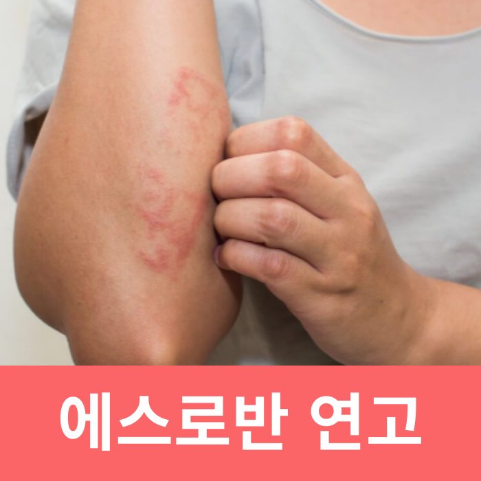  에스로반 연고 효능 항생제 모낭염
