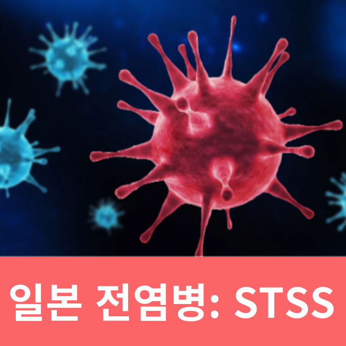  일본 전염병 STSS 연쇄구균독성쇼크증후군 확산 증상