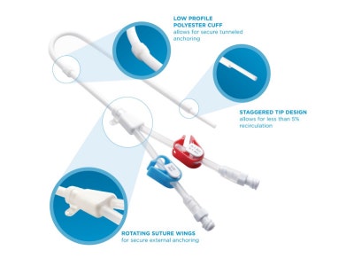 [투석]“투석할 때 쓰는 Catheter 정리해주세요”편 // AVF, perm catheter, Duallumen : 네이버 블로그