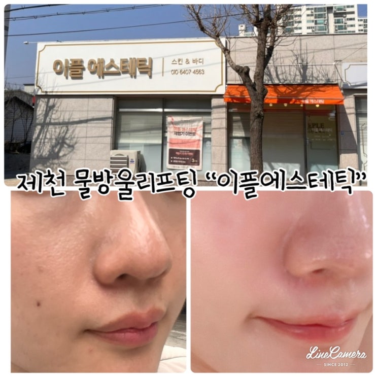  제천 피부관리 이플에스테틱 물방울 리프팅 수분관리 후기