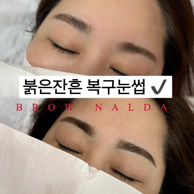  호매실동눈썹문신 후에도 민낯으로 다닐 수 없는 이유