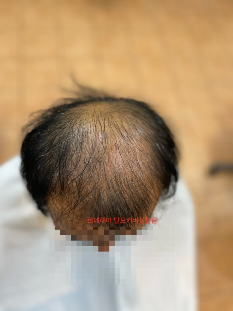  결혼식 혼주 아빠의 도전 부산사상르네시떼미용실/ 탈모관리 탈모 펌 탈모 컷 탈모 해독 염색 극 속상 모발클리닉