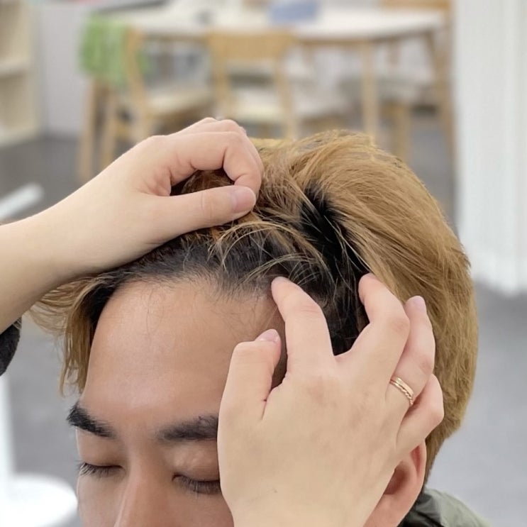  인천 두피 문신 남자 탈모 헤어라인 SMP 두피 타투 상담 후기