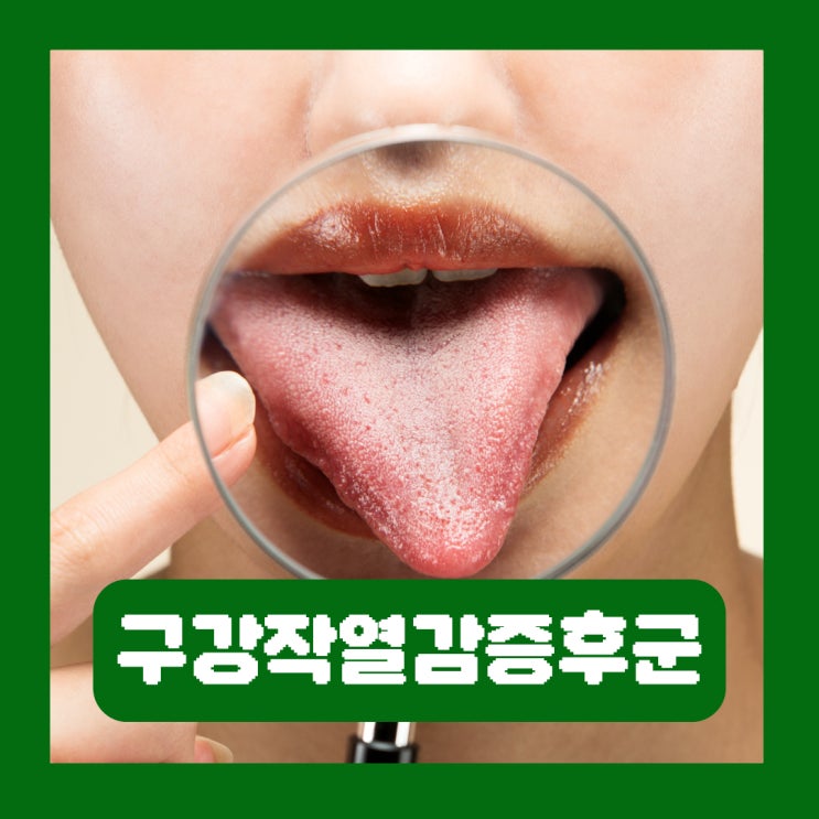  구강작열감증후군 기본정보 원인 혀통증 불난 혀 증상