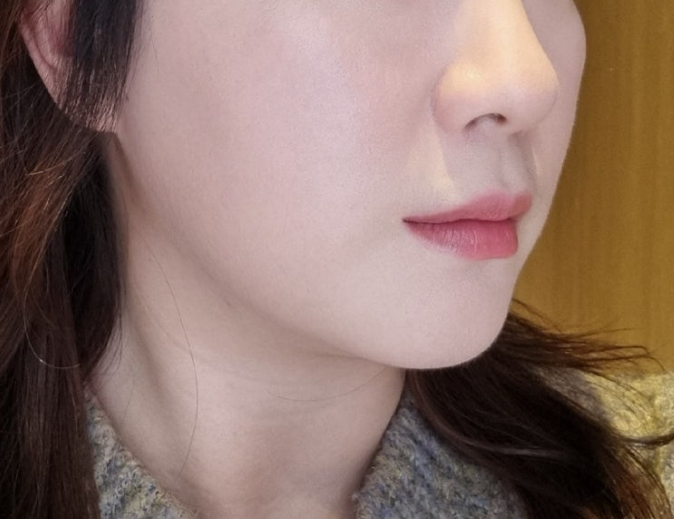  홍대 티타늄리프팅 2회차 효과 전후비교 찐후기