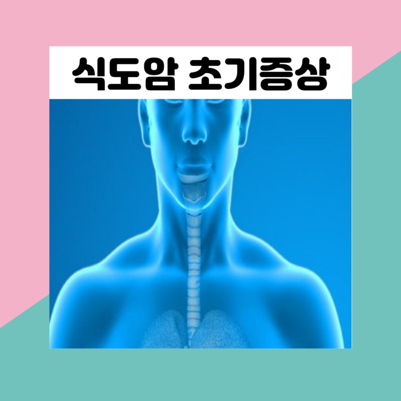 식도암 초기 증상 증세 원인과 생존율 검사 치료 예방법