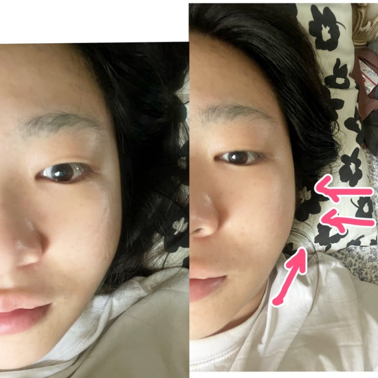  대구 예신관리나 얼굴비대칭 교정으로 추천하는 '얼굴균형' 관리 ! 더테라피 중구점  후기 (더테라피중구점주차/얼굴균형 비포애프터 사진 첨부.)